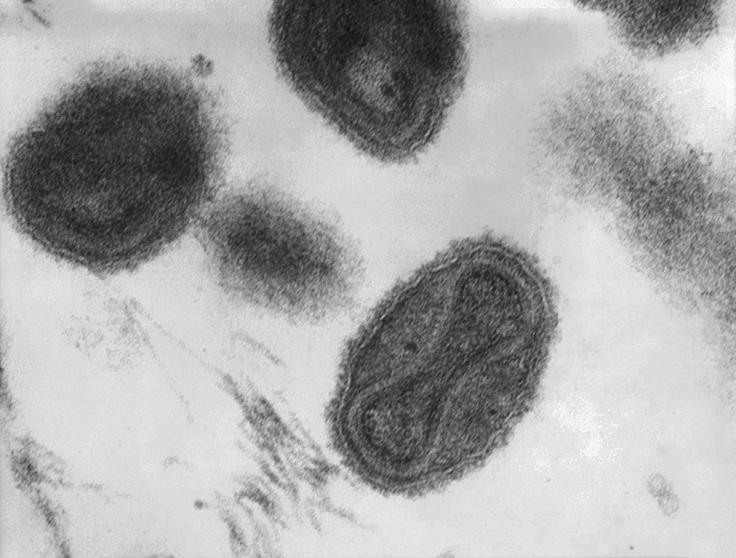 The Overlooked, Dangerous Nexus Between National Security and Public Health: The Case of Smallpox